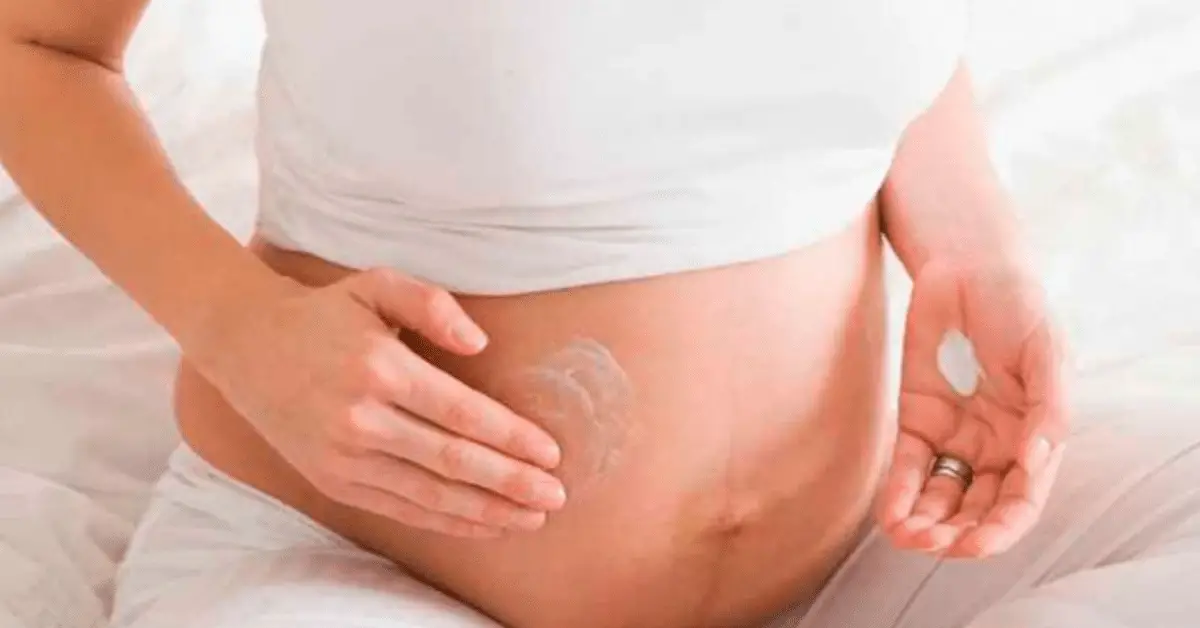 Como evitar estrias durante a gravidez