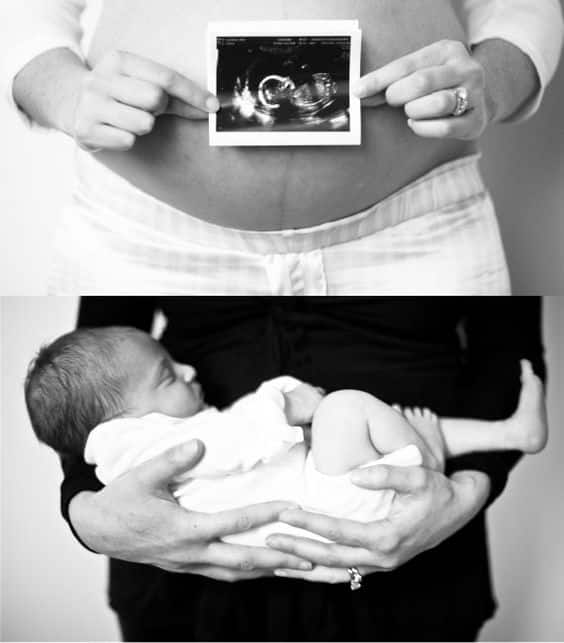 fotos antes depois gravidez 4