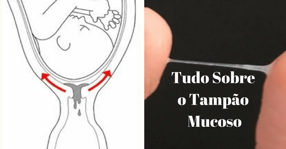 tampao mucoso