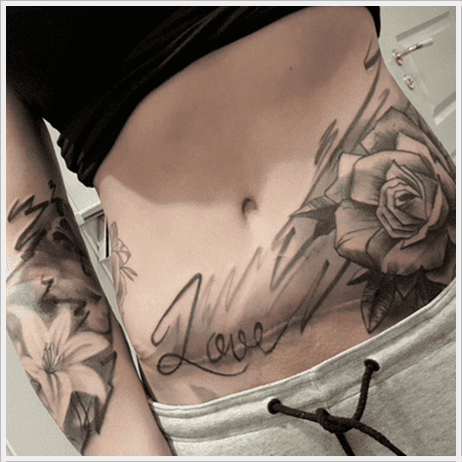 tatuagem cicatriz cesaria